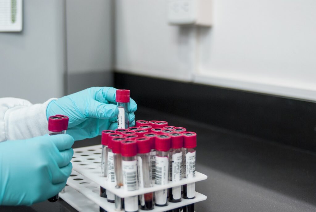 An illustration depicting various drug test kits with a focus on standard drug tests.